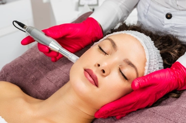 Microneedling